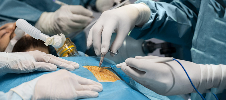 Precision Healing with Laparoscopic Surgery in Vizag