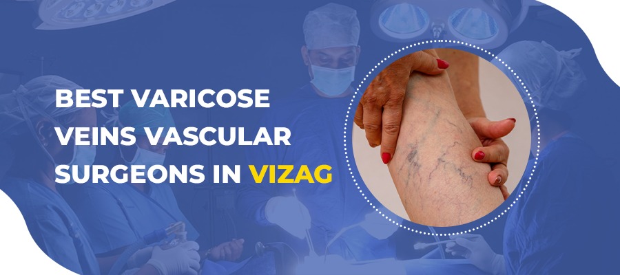 Best Varicose Veins Vascular Surgeons in Vizag